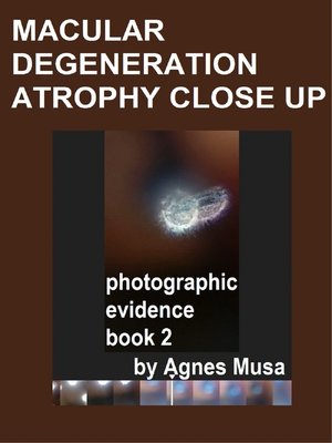 cover image of Macular Degeneration Atrophy Close Up, Photographic Evidence Book 2